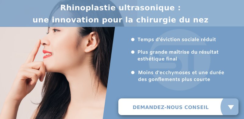Rhinoplastie ultrasonique comme innovation pour effacer la bosse du nez